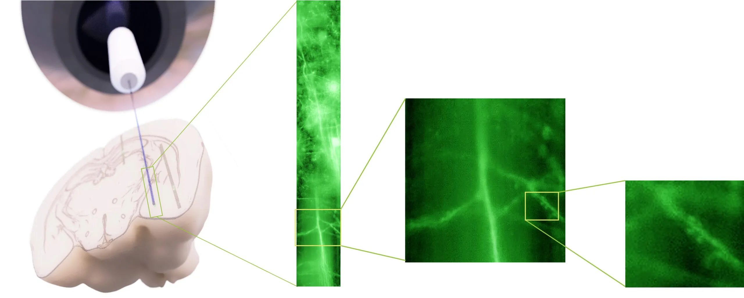Endoskopie-Bild des Tiefenhirns