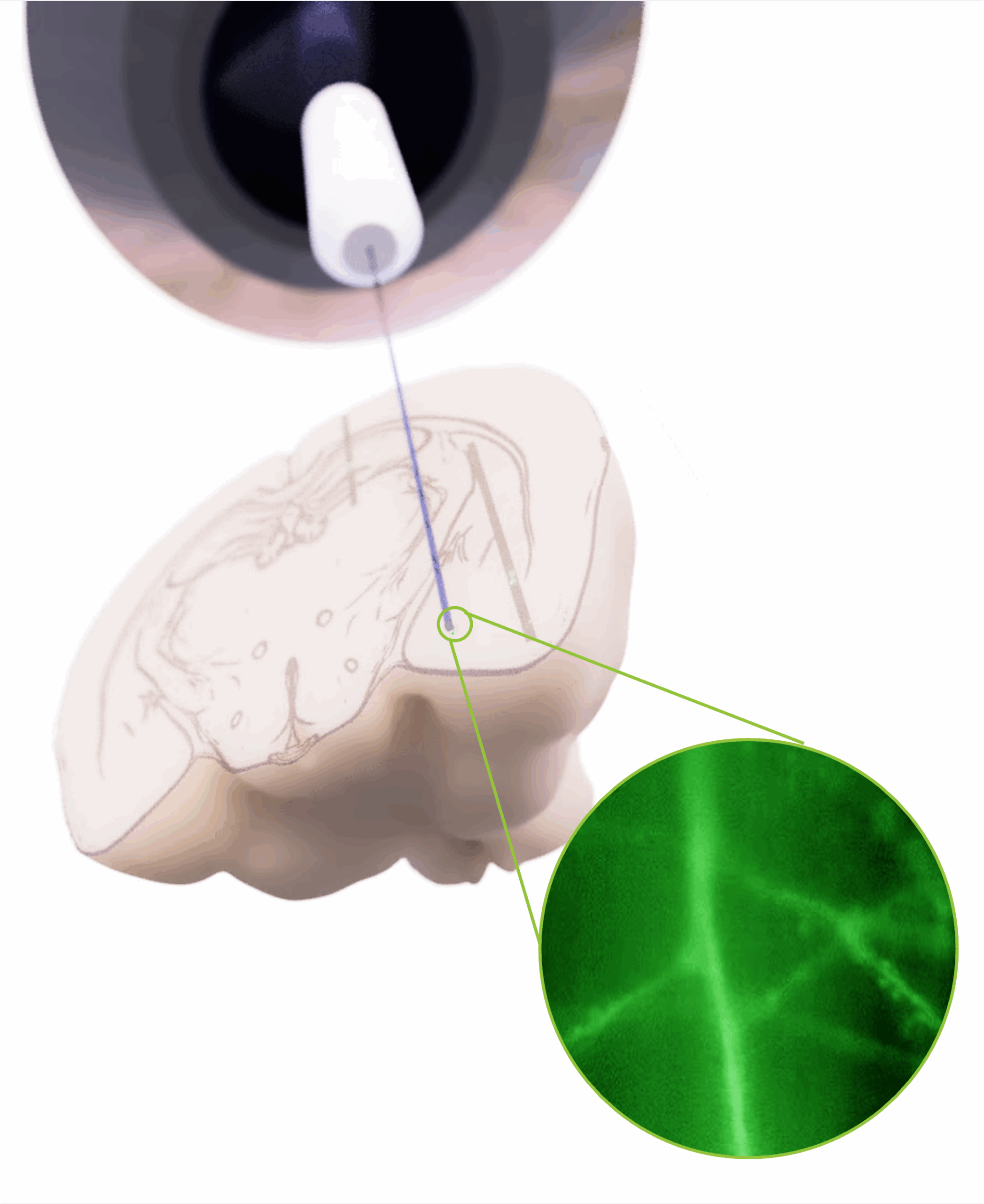 Brain and fibre